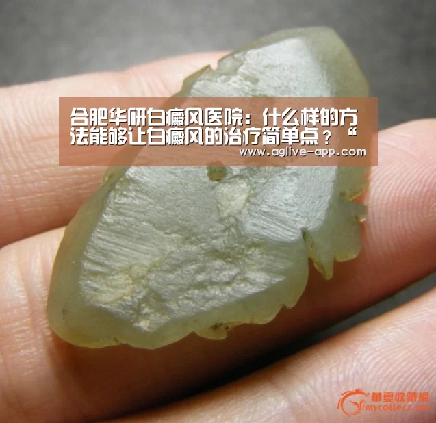 合肥华研白癜风医院:什么样的方法能够让白癜风的治疗简单点?“AG官方”(图1) AG电竞